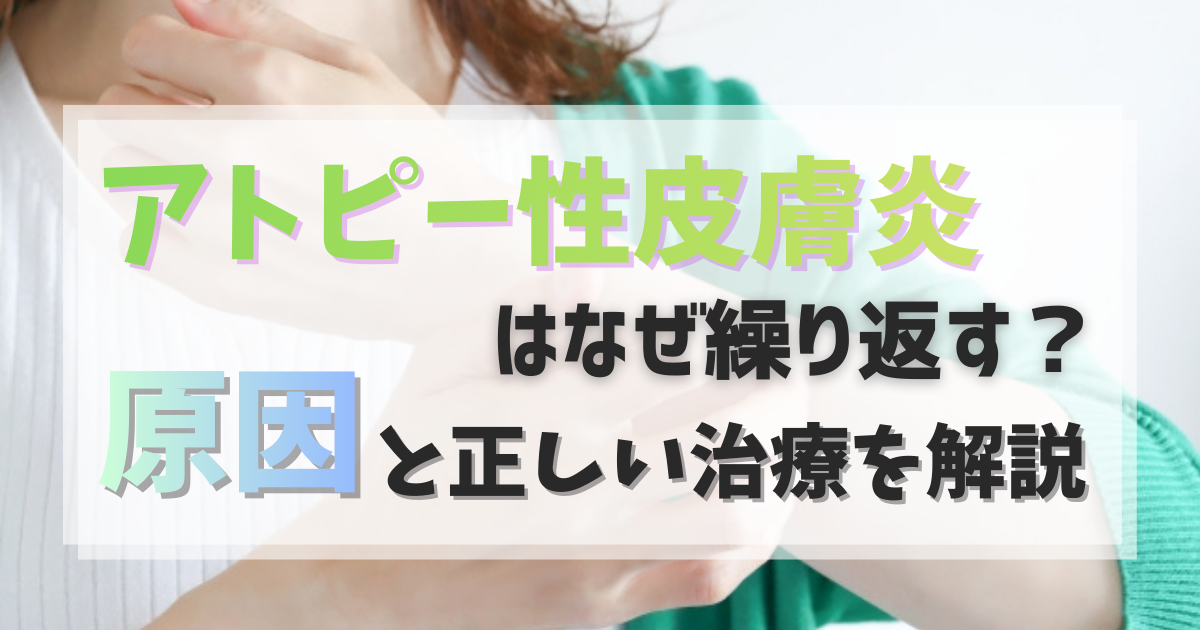 アトピー性皮膚炎はなぜ繰り返す？原因と正しい治療を解説