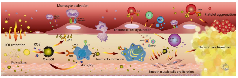 LDL（悪玉）コレステロール
