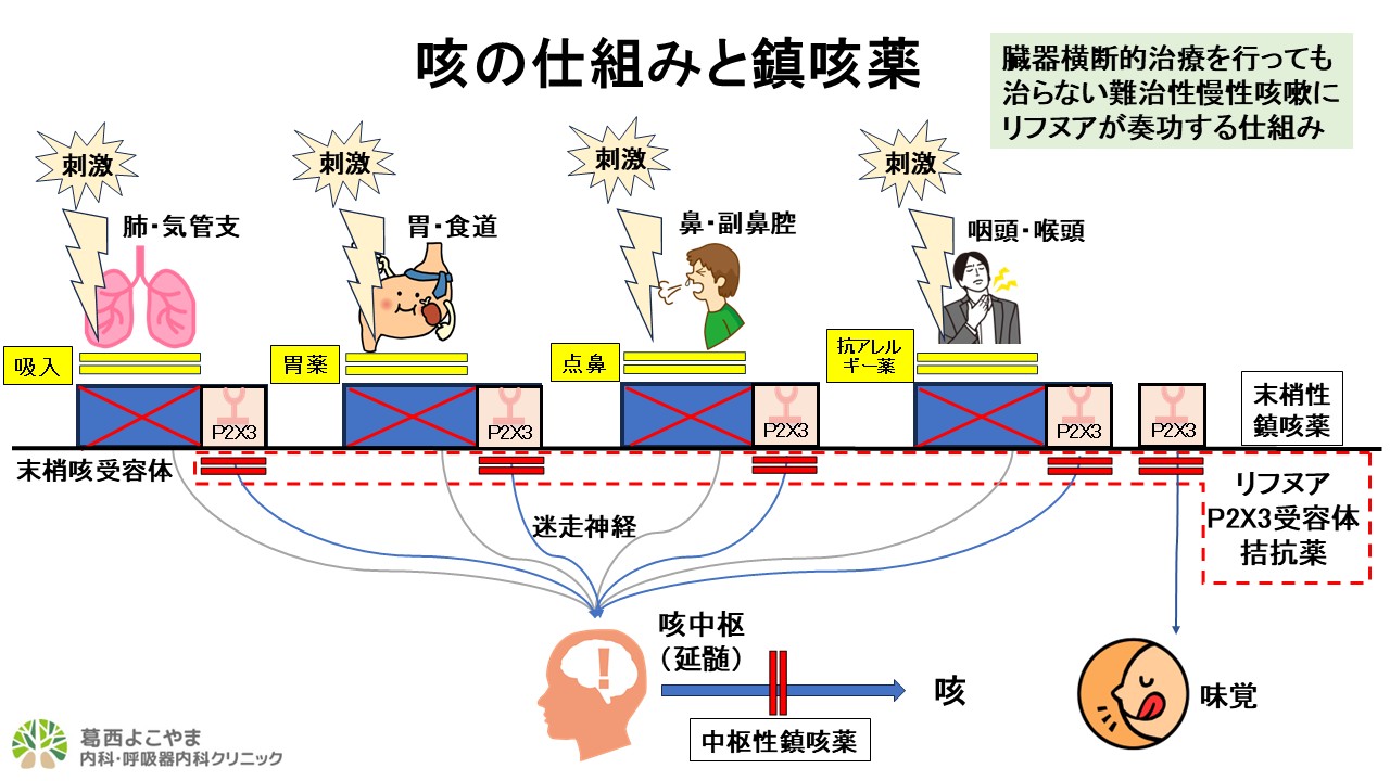 リフヌア（ゲーファピキサント）【難治性慢性咳嗽治療薬】