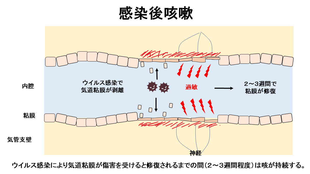 感染後咳嗽の仕組み