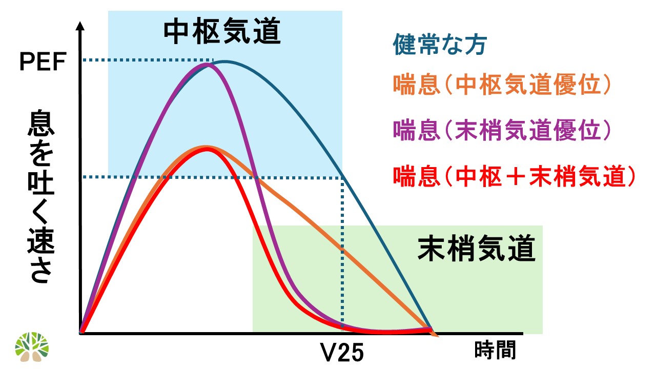 フローボリューム曲線：中枢気道と末梢気道