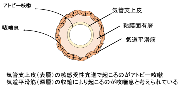 アトピー咳嗽と咳喘息のメカニズムの違い