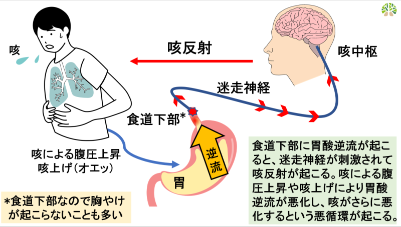 逆流