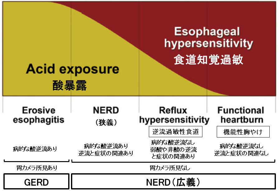 GERD/NER病態の違い