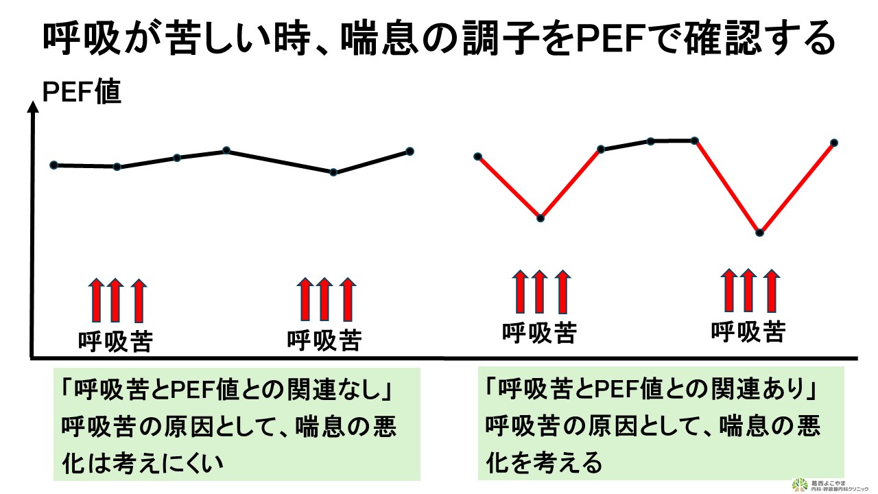 呼吸が苦しい時はピークフローを吹きましょう