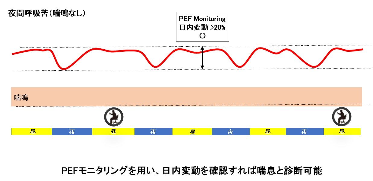 喘鳴がなく夜間の呼吸苦のみ認めるような場合でも、PEFモニタリングを用いれば喘息と診断可能である