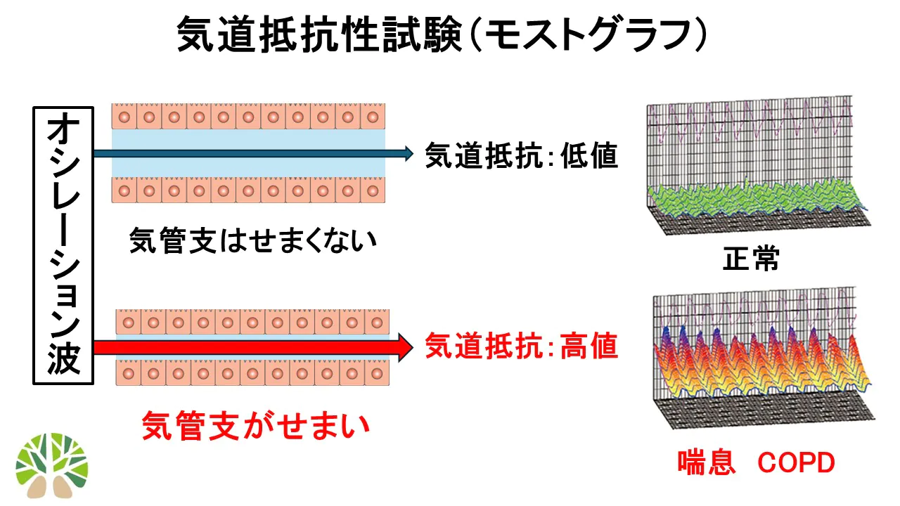 気道抵抗性試験の仕組み