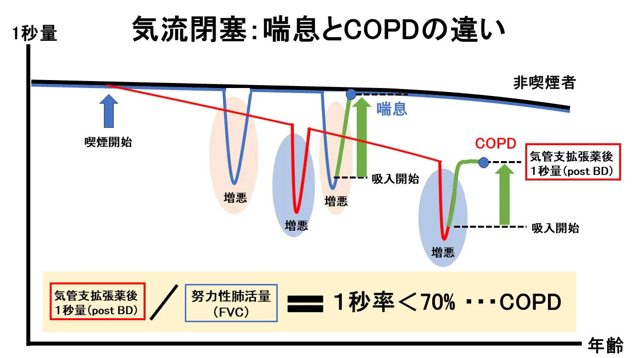 気流閉塞：喘息とCOPDの違い