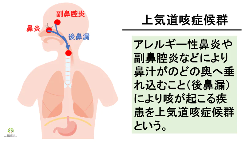 鼻が喉の奥に垂れ込むことによっておこる咳を上気道咳症候群という